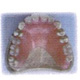 CX義歯